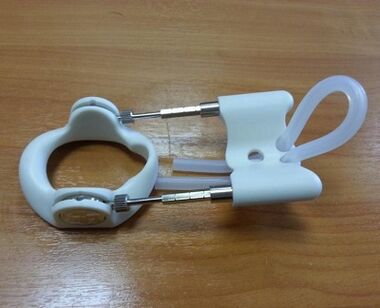 Extender after an operation to increase the member