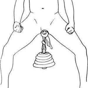 Hanging a weight is a dangerous method of penis enlargement