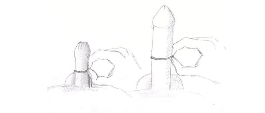 Measuring penis thickness